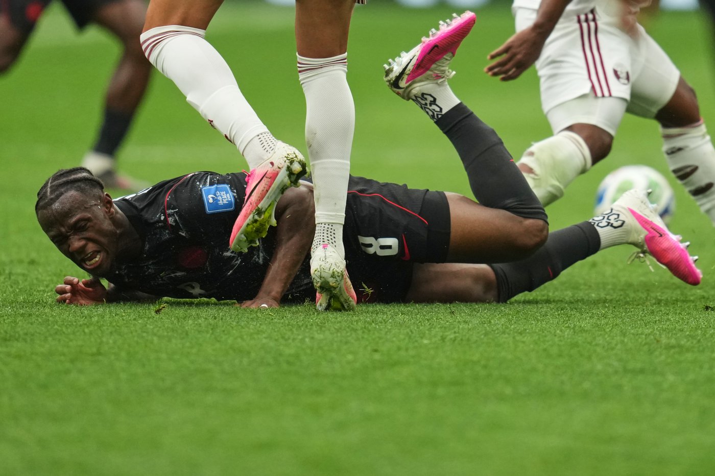 Canada's Ismaël Koné has surgery for 2 broken bones in leg from World Cup match against Qatar | iNFOnews.ca