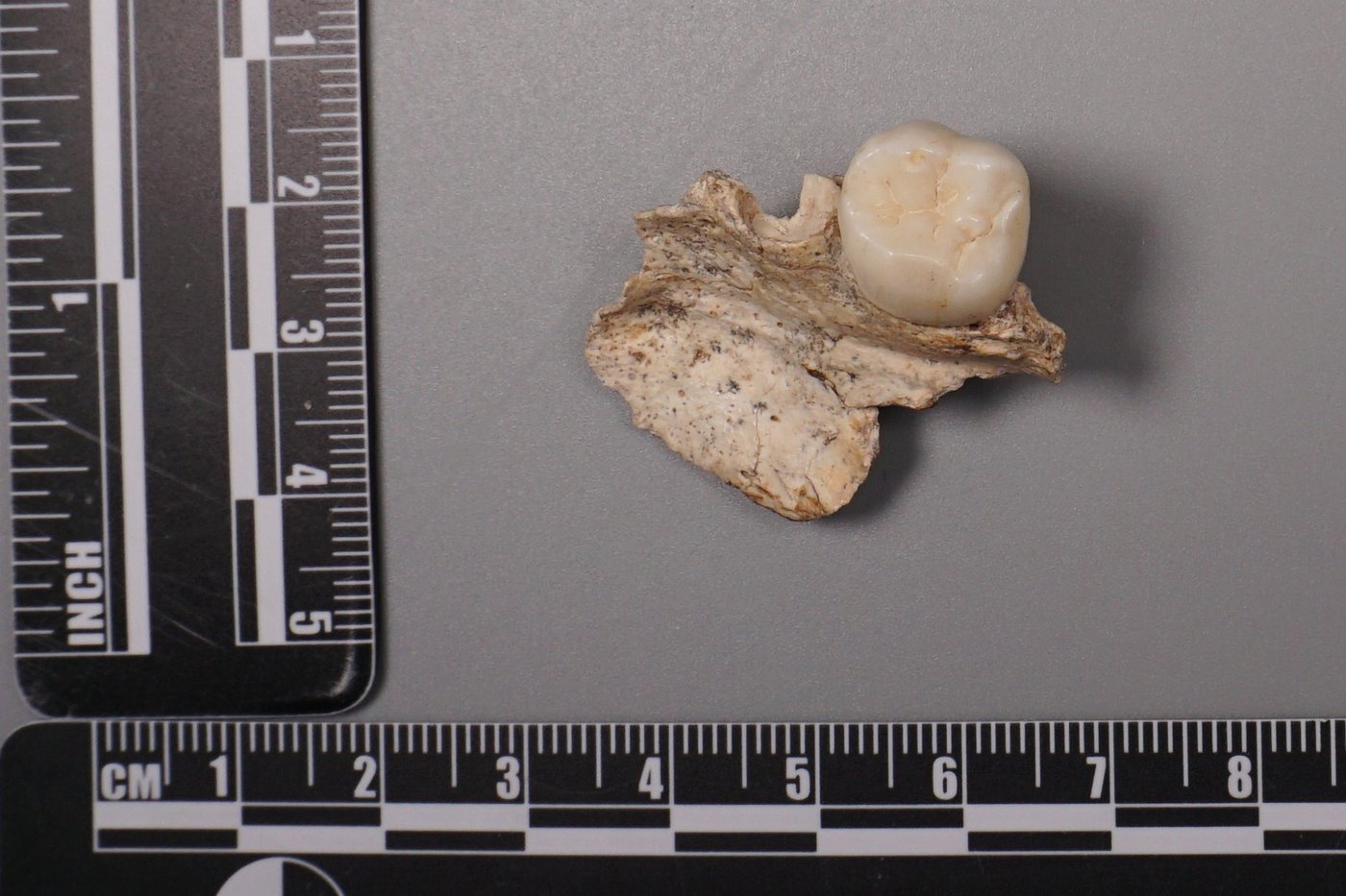 Ancient teeth hint at canoodling between early human relatives | iNFOnews.ca