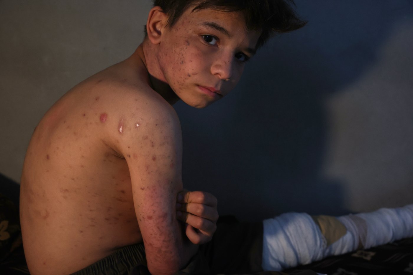 A grieving father buries his 6-year-old after a land mine kills 3 children in Syria's Idlib | iNFOnews.ca
