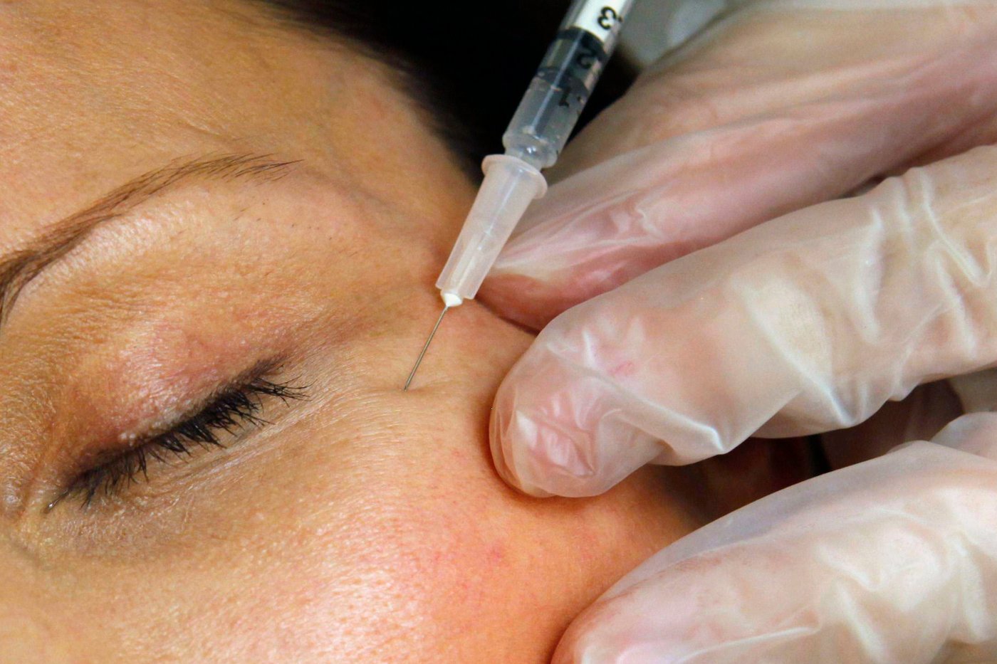 Cosmetic interventions are booming. Many say ethical conversations are lagging | iNFOnews.ca
