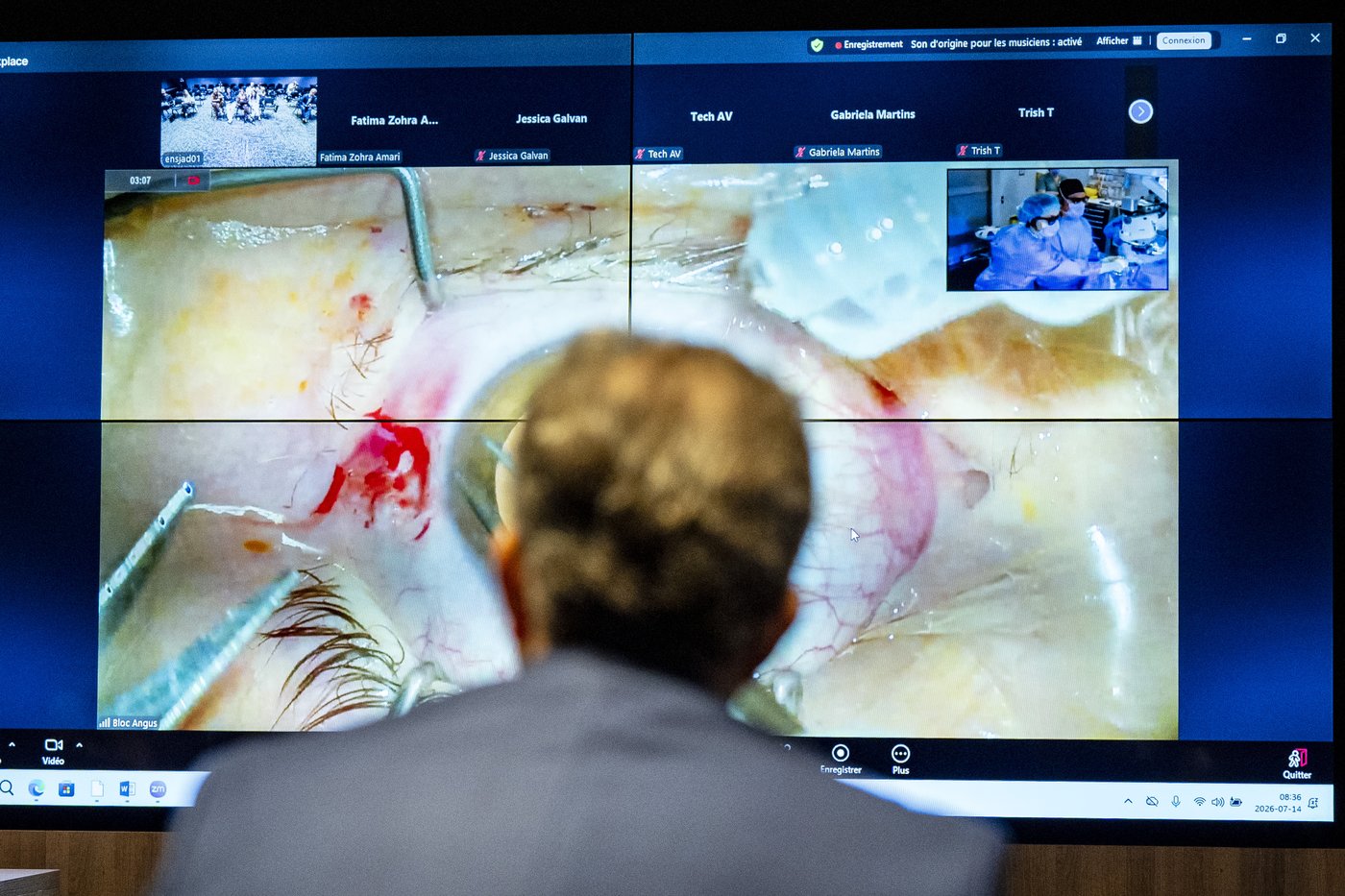 Montreal hospital livestreams surgeries for educational purposes | iNFOnews.ca