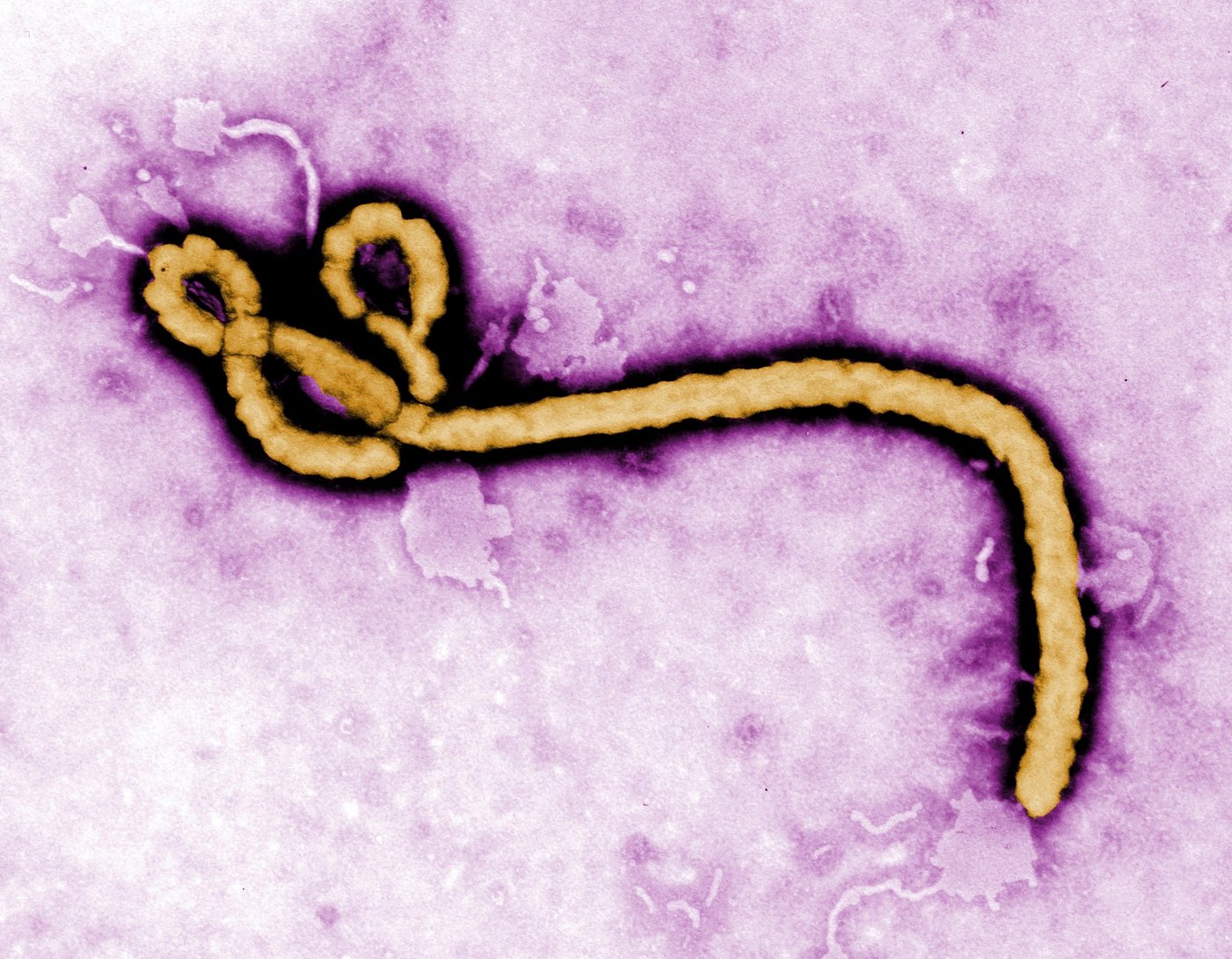 WHO declares global health emergency over Ebola outbreak in Congo and Uganda | iNFOnews.ca