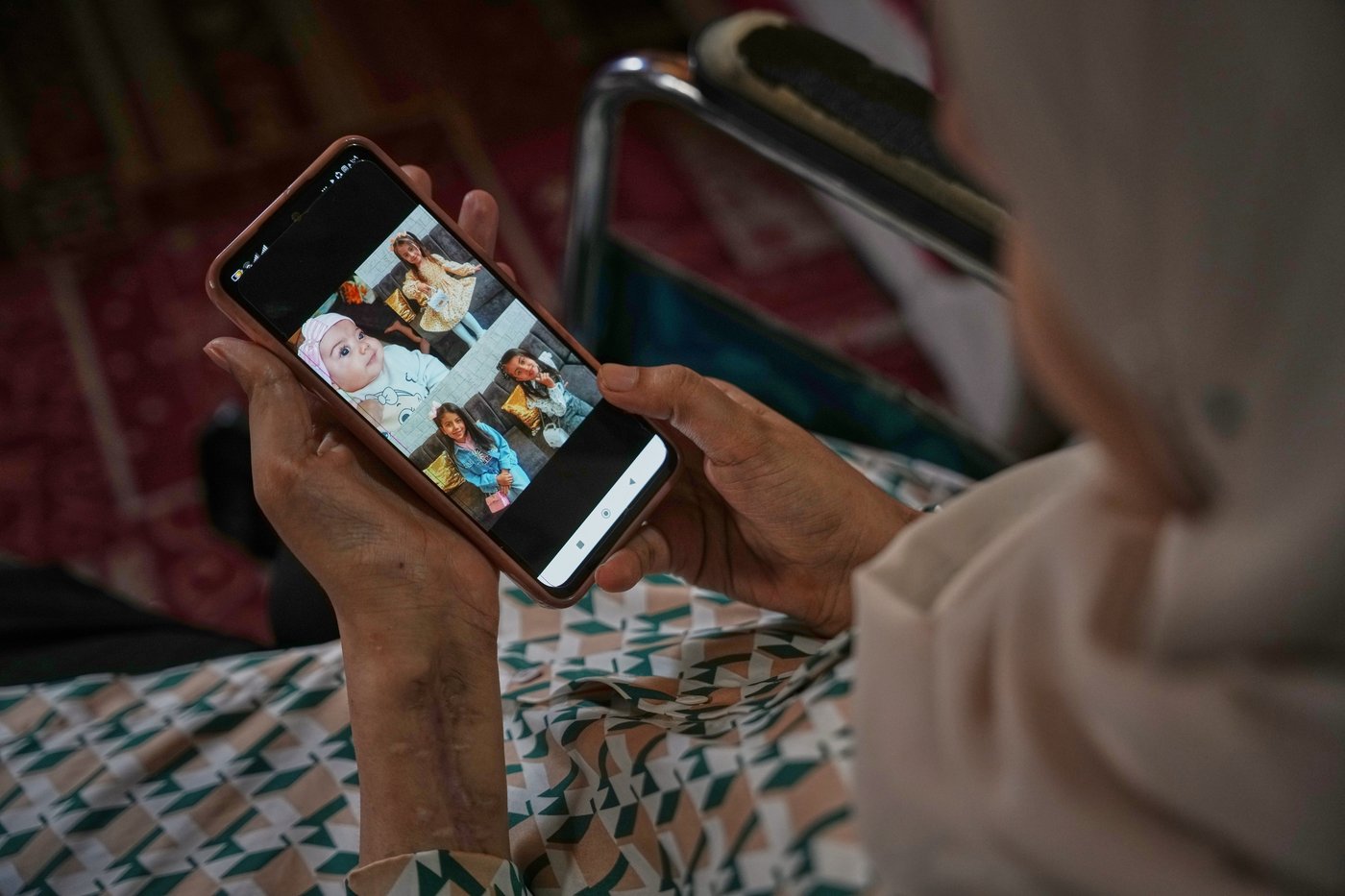 Photos of amputees in Gaza, struggling to survive after losing limbs to Israeli airstrikes | iNFOnews.ca