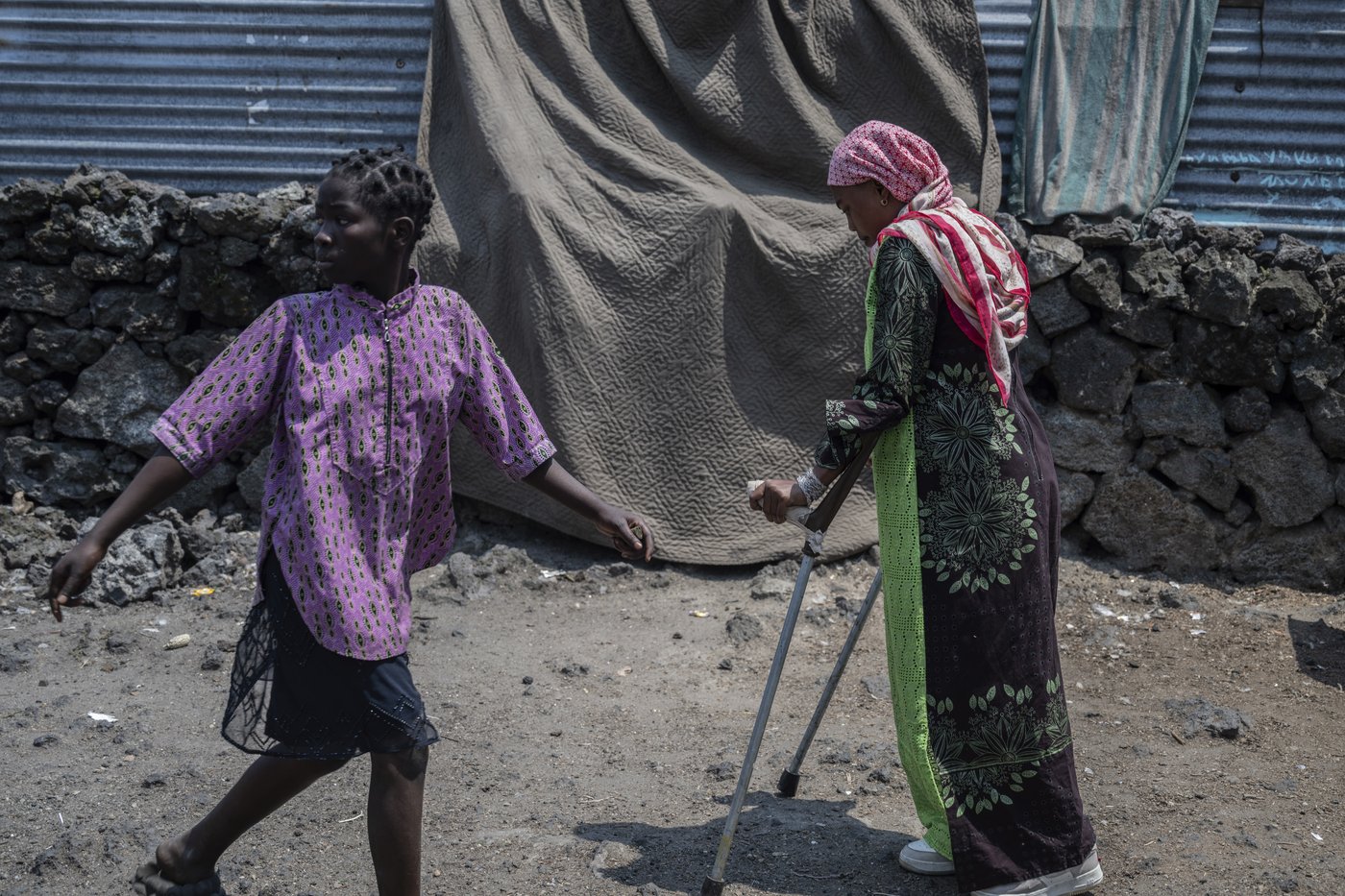 Photos of an orthopedic center in Congo that helps amputees regain mobility | iNFOnews.ca
