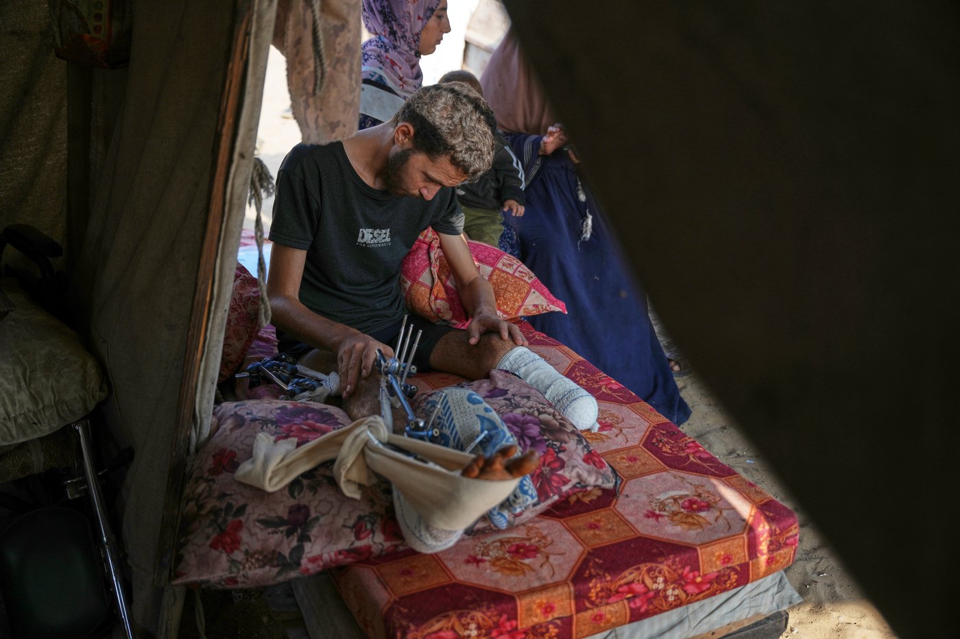 Photos of amputees in Gaza, struggling to survive after losing limbs to Israeli airstrikes | iNFOnews.ca