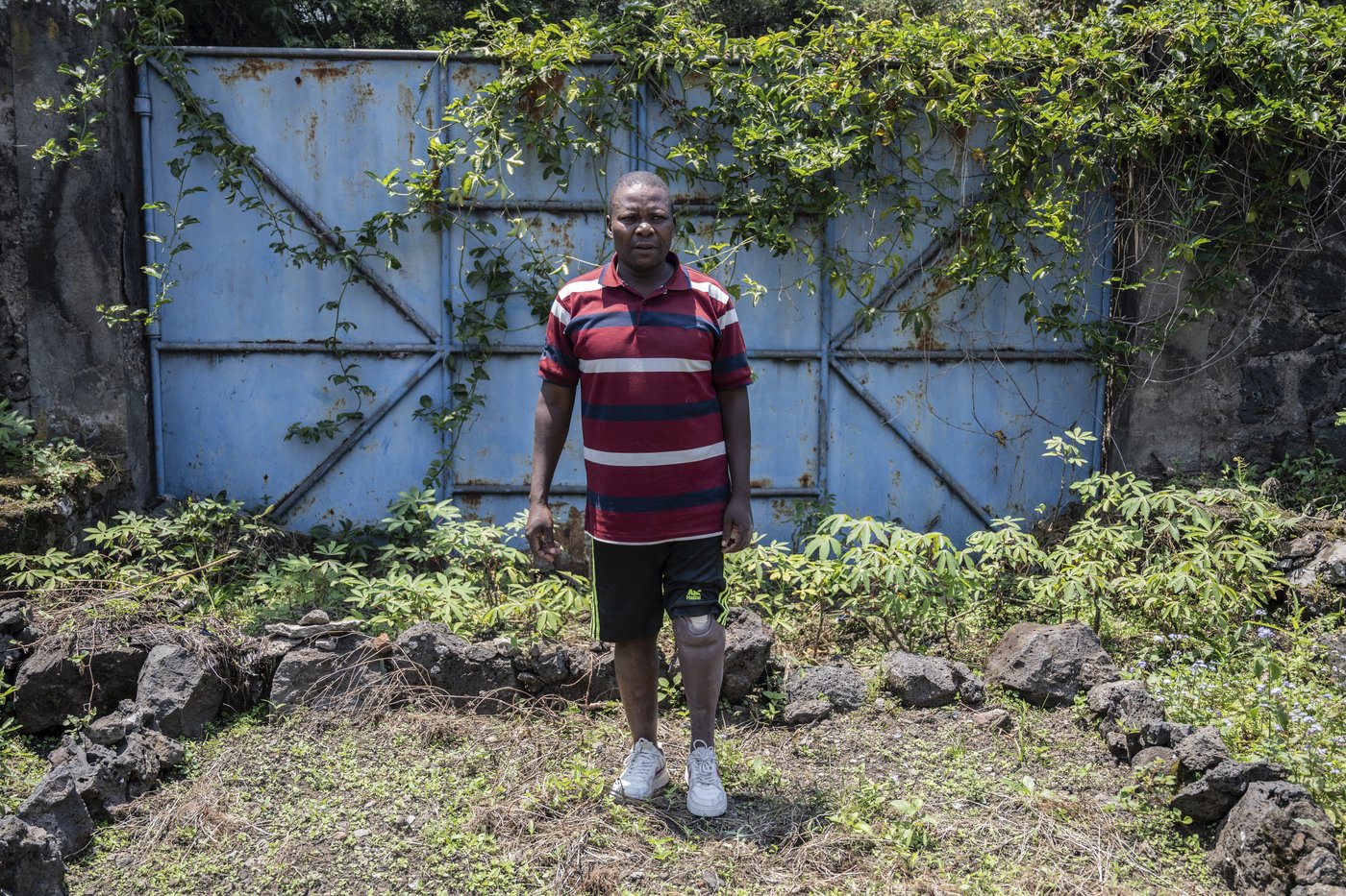 Photos of an orthopedic center in Congo that helps amputees regain mobility | iNFOnews.ca