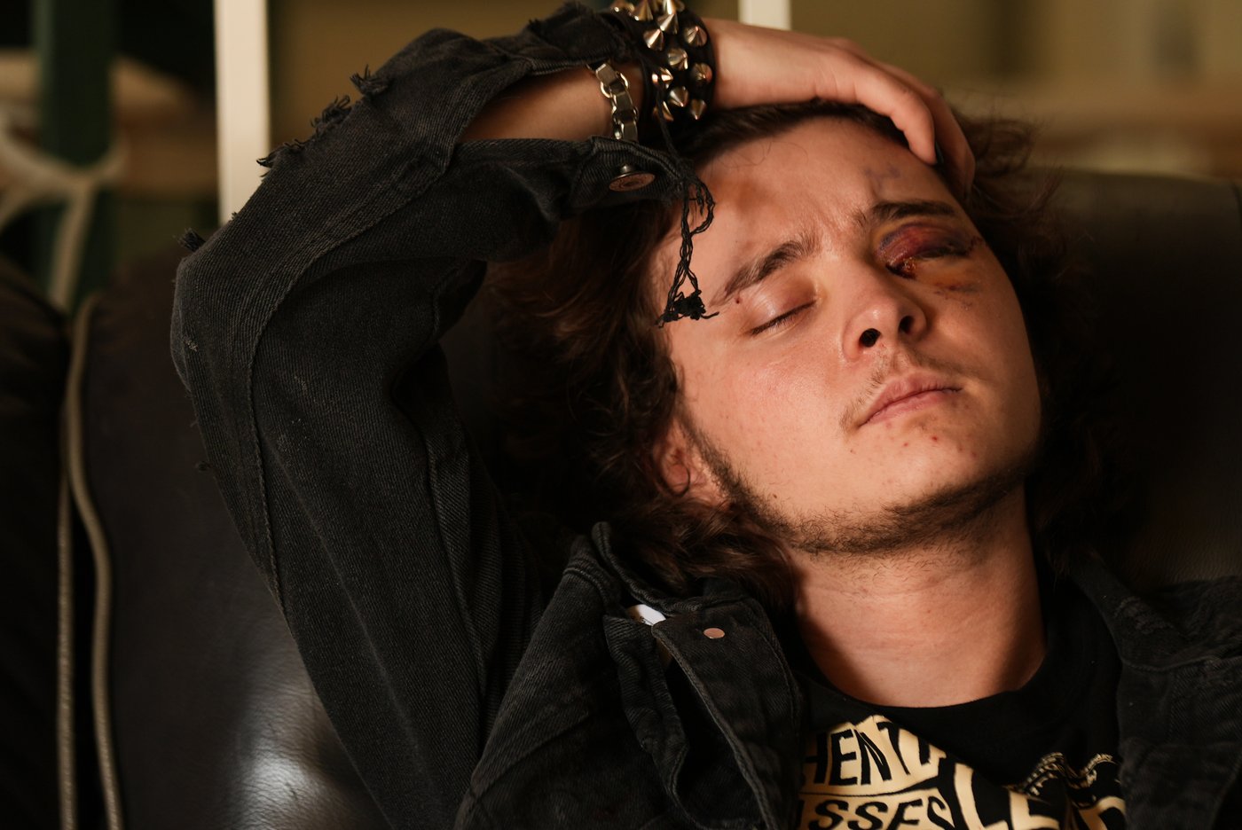 Demonstrator injured after federal agent fired projectile from close range during California protest | iNFOnews.ca