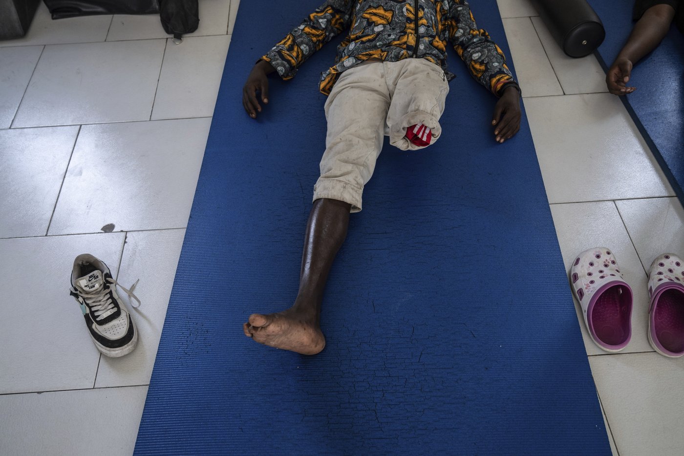 Photos of an orthopedic center in Congo that helps amputees regain mobility | iNFOnews.ca