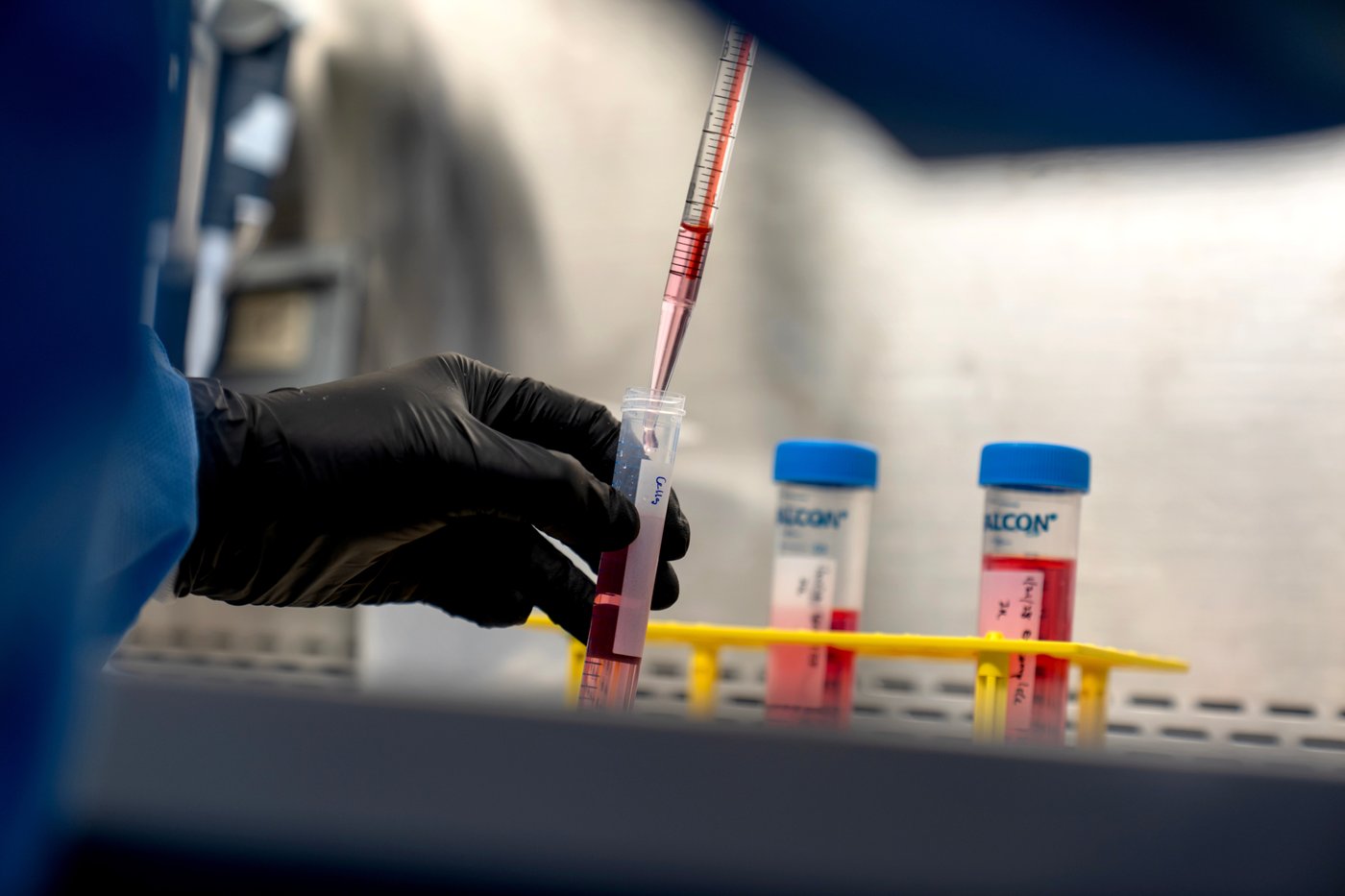 Lifelong drugs for autoimmune diseases don't work well. Now scientists are trying something new | iNFOnews.ca