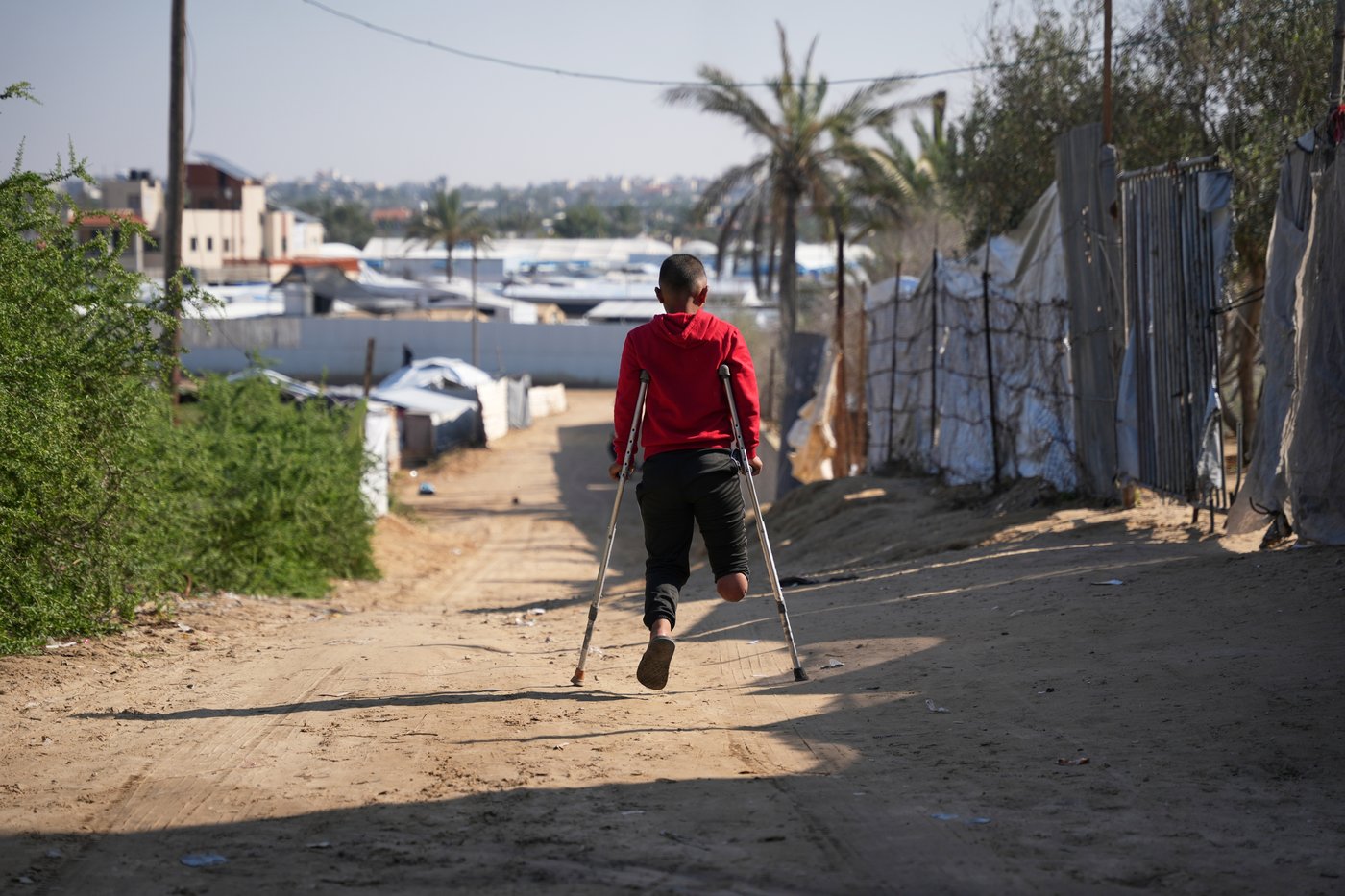Photos of amputees in Gaza, struggling to survive after losing limbs to Israeli airstrikes | iNFOnews.ca