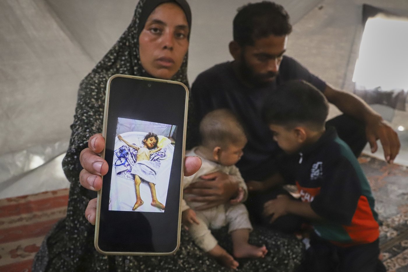 Malnourished kids arrive daily at a Gaza hospital as Netanyahu denies hunger | iNFOnews.ca Malnourished kids arrive daily at a Gaza hospital as Netanyahu denies hunger | iNFOnews.ca