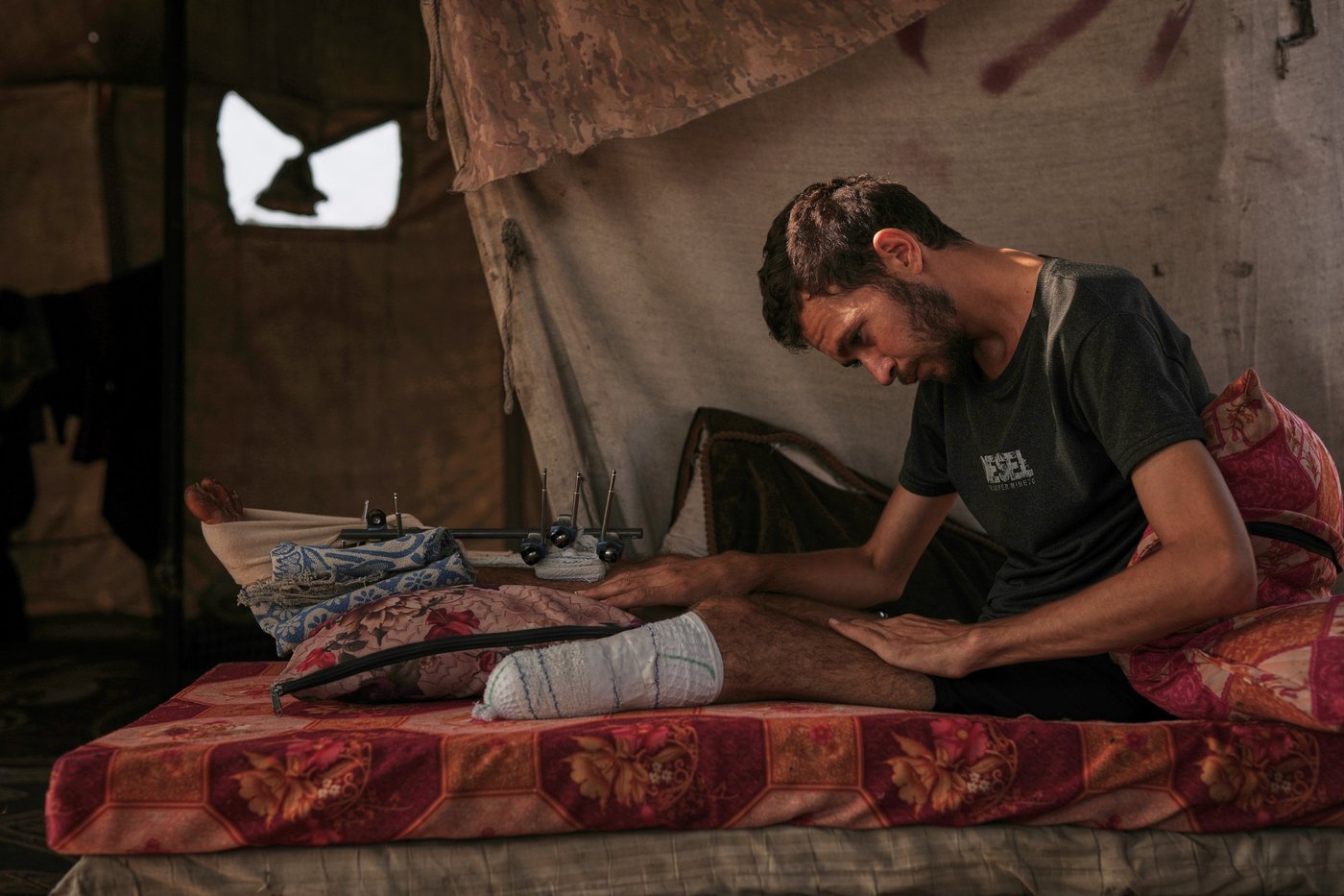 Photos of amputees in Gaza, struggling to survive after losing limbs to Israeli airstrikes | iNFOnews.ca