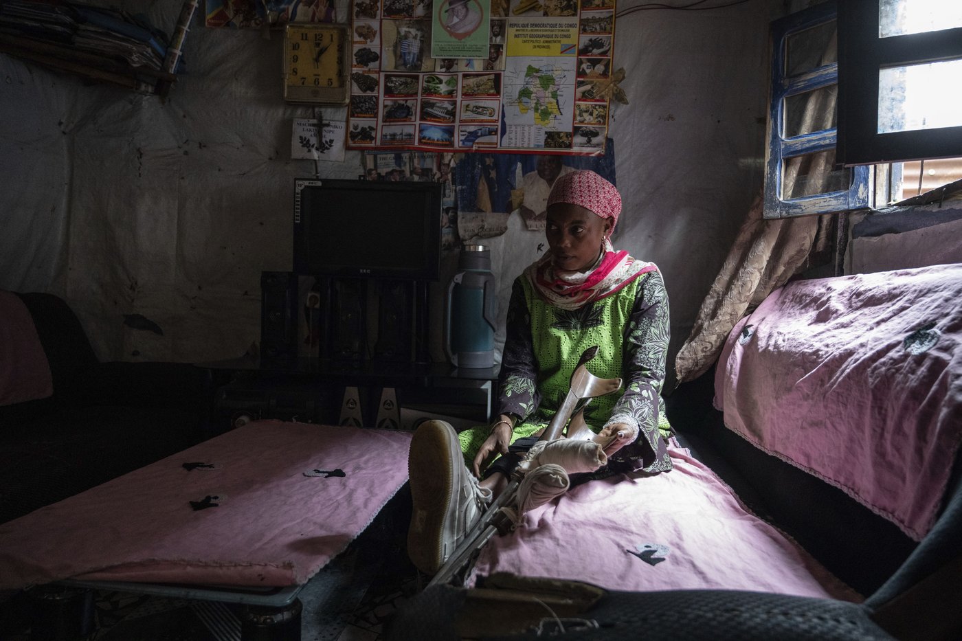 Photos of an orthopedic center in Congo that helps amputees regain mobility | iNFOnews.ca