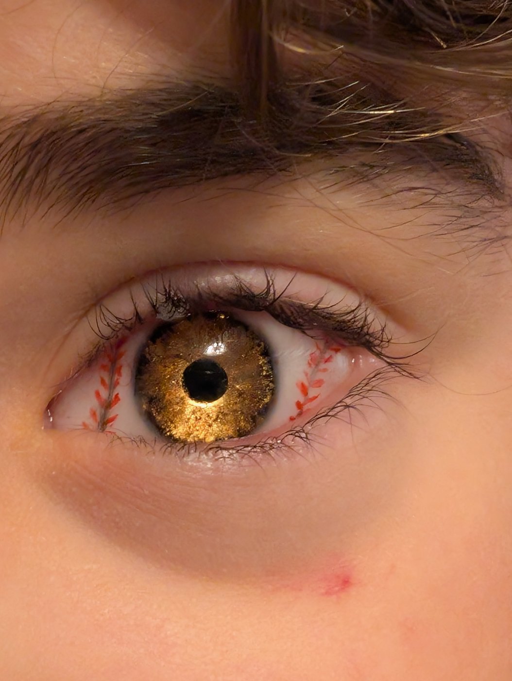 Eight-year-old shows his love for the Blue Jays with custom prosthetic eye | iNFOnews.ca Eight-year-old shows his love for the Blue Jays with custom prosthetic eye | iNFOnews.ca