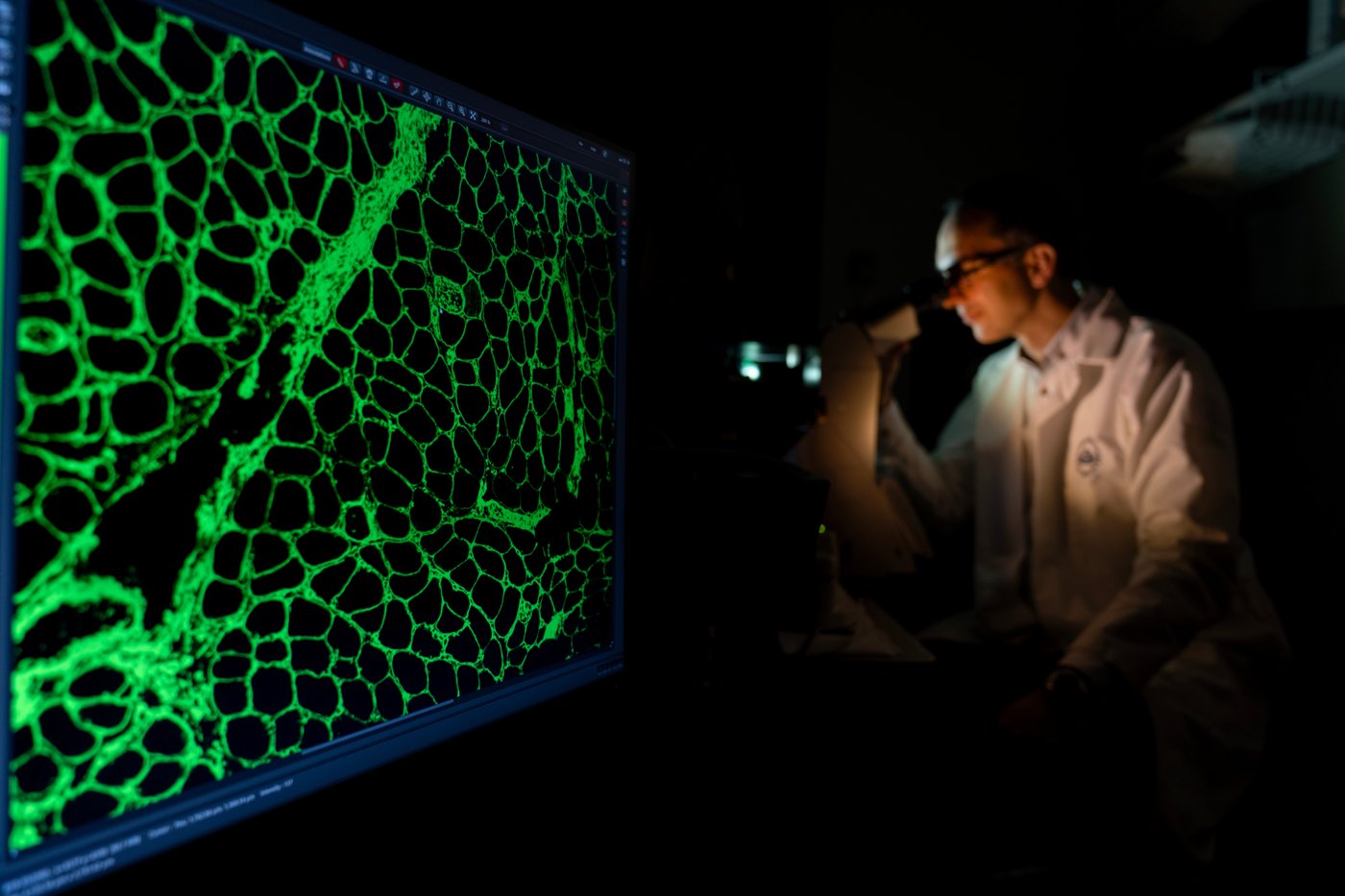 PHOTO ESSAY: Scientists trying to unravel one of the body's biggest mysteries | iNFOnews.ca