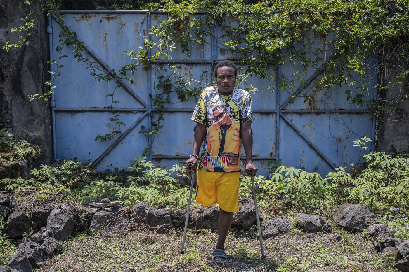 Photos of an orthopedic center in Congo that helps amputees regain mobility | iNFOnews.ca