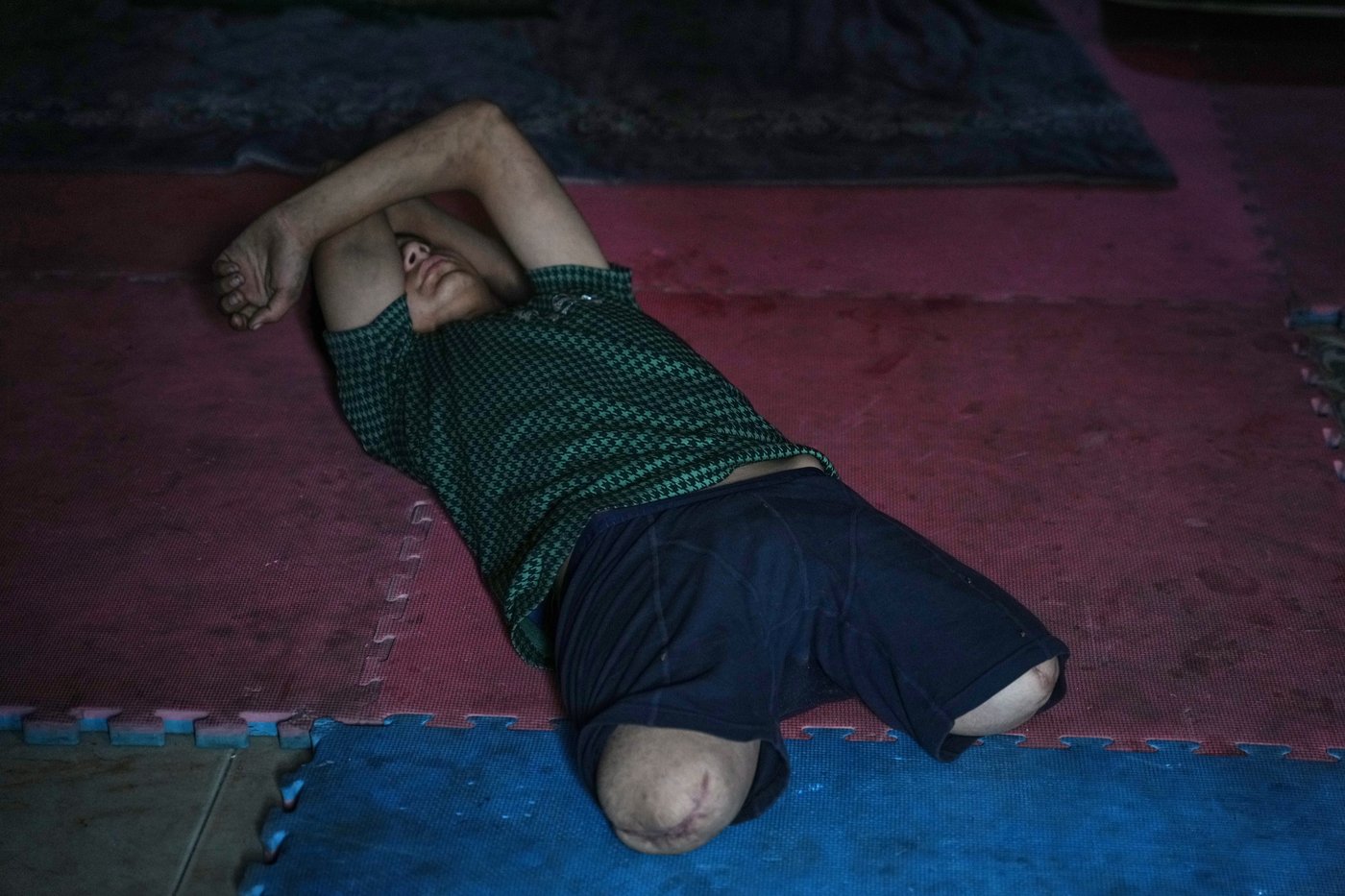 Photos of amputees in Gaza, struggling to survive after losing limbs to Israeli airstrikes | iNFOnews.ca